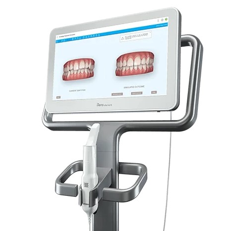 Escaneamento digital para simulação do sorriso na consulta